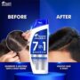 Head AND SHOULDERS 7IN 1 SHAMPOO BENEFITS 180ML WITH ALMOND MILK